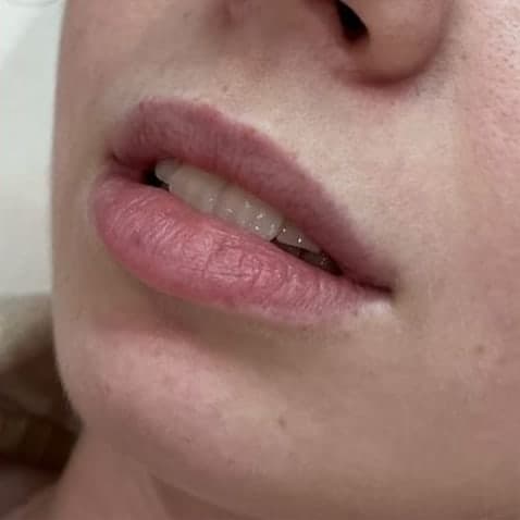 A client's lips in profile, slightly parted